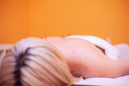 Tratamiento con acupuntura para adelgazar - foto 1
